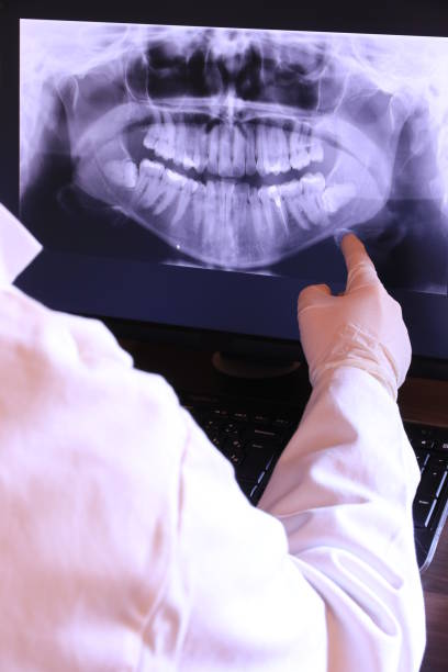 Best Emergency Dental Care for Broken or Chipped Teeth in Pontiac, IL