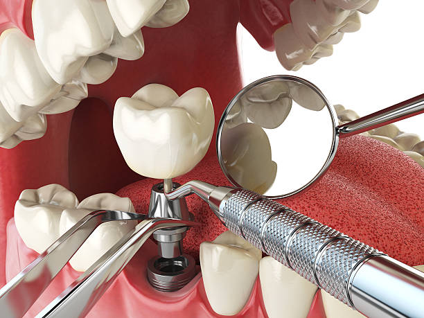 Best After-Hours Dental Trauma Care in Pontiac, IL
